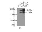 MYO18A Antibody in Immunoprecipitation (IP)