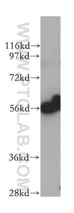 LAP3 Antibody in Western Blot (WB)