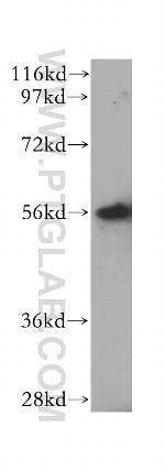 LAP3 Antibody in Western Blot (WB)