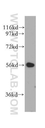 LAP3 Antibody in Western Blot (WB)