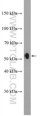 LAP3 Antibody in Western Blot (WB)