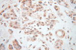 RBPJ Antibody in Immunohistochemistry (Paraffin) (IHC (P))