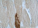 ST3GAL5 Antibody in Immunohistochemistry (Paraffin) (IHC (P))