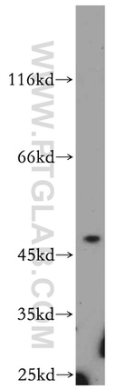 ST3GAL5 Antibody in Western Blot (WB)