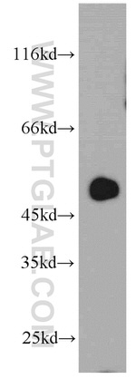 ST3GAL5 Antibody in Western Blot (WB)