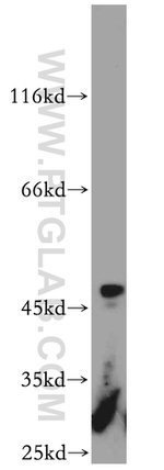 ST3GAL5 Antibody in Western Blot (WB)