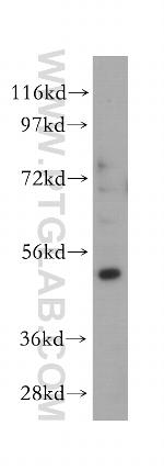 ST3GAL5 Antibody in Western Blot (WB)