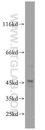 ST3GAL5 Antibody in Western Blot (WB)