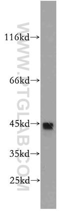 ST3GAL5 Antibody in Western Blot (WB)