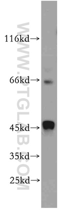 ST3GAL5 Antibody in Western Blot (WB)