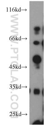 ST3GAL5 Antibody in Western Blot (WB)