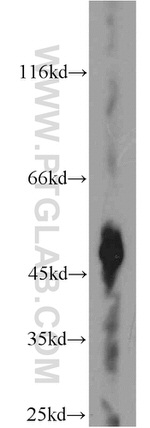 ST3GAL5 Antibody in Western Blot (WB)