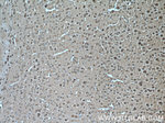 KIF17 Antibody in Immunohistochemistry (Paraffin) (IHC (P))