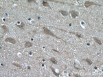 KIF17 Antibody in Immunohistochemistry (Paraffin) (IHC (P))