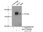 KIF17 Antibody in Immunoprecipitation (IP)