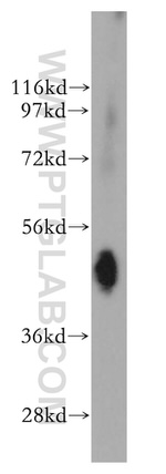 NMUR1 Antibody in Western Blot (WB)