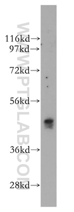 NMUR1 Antibody in Western Blot (WB)