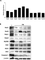 MyD88 Antibody in Western Blot (WB)