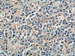 SHARPIN Antibody in Immunohistochemistry (Paraffin) (IHC (P))