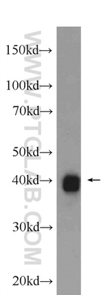 SHARPIN Antibody in Western Blot (WB)