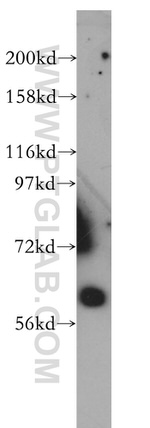 ABCB10 Antibody in Western Blot (WB)