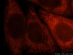 AFG3L2 Antibody in Immunocytochemistry (ICC/IF)