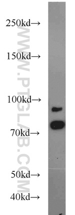 AFG3L2 Antibody in Western Blot (WB)