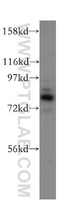 AFG3L2 Antibody in Western Blot (WB)