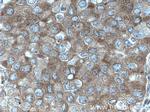 DDX6 Antibody in Immunohistochemistry (Paraffin) (IHC (P))