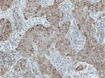 DDX6 Antibody in Immunohistochemistry (Paraffin) (IHC (P))