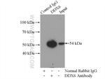 DDX6 Antibody in Immunoprecipitation (IP)