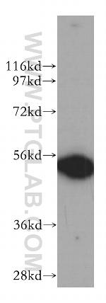 DDX6 Antibody in Western Blot (WB)