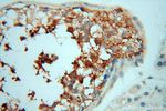 PPP1R15B Antibody in Immunohistochemistry (Paraffin) (IHC (P))