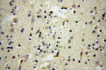 PPP1R15B Antibody in Immunohistochemistry (Paraffin) (IHC (P))