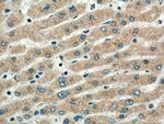 SRPRB Antibody in Immunohistochemistry (Paraffin) (IHC (P))