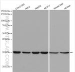 SRPRB Antibody in Western Blot (WB)