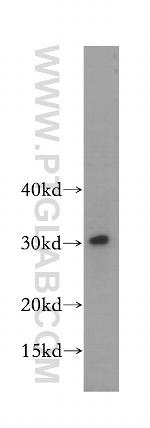 SRPRB Antibody in Western Blot (WB)