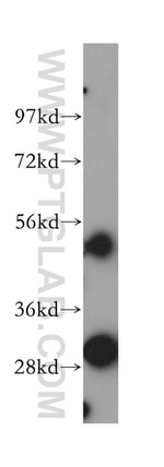 SRPRB Antibody in Western Blot (WB)