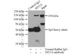 SIN3A Antibody in Immunoprecipitation (IP)