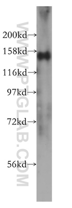 SIN3A Antibody in Western Blot (WB)