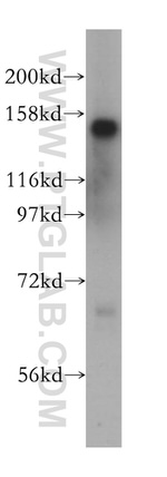 SIN3A Antibody in Western Blot (WB)