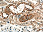 CHMP1B Antibody in Immunohistochemistry (Paraffin) (IHC (P))