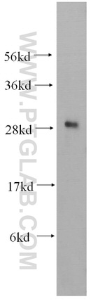 CHMP1B Antibody in Western Blot (WB)