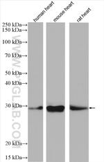 CHMP1B Antibody in Western Blot (WB)