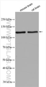 Beta adducin Antibody in Western Blot (WB)