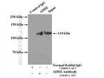 Beta adducin Antibody in Immunoprecipitation (IP)