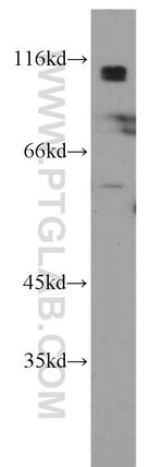 Beta adducin Antibody in Western Blot (WB)