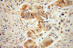 IGF2BP3 Antibody in Immunohistochemistry (Paraffin) (IHC (P))