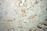 IGF2BP3 Antibody in Immunohistochemistry (Paraffin) (IHC (P))