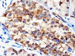 IGF2BP3 Antibody in Immunohistochemistry (Paraffin) (IHC (P))